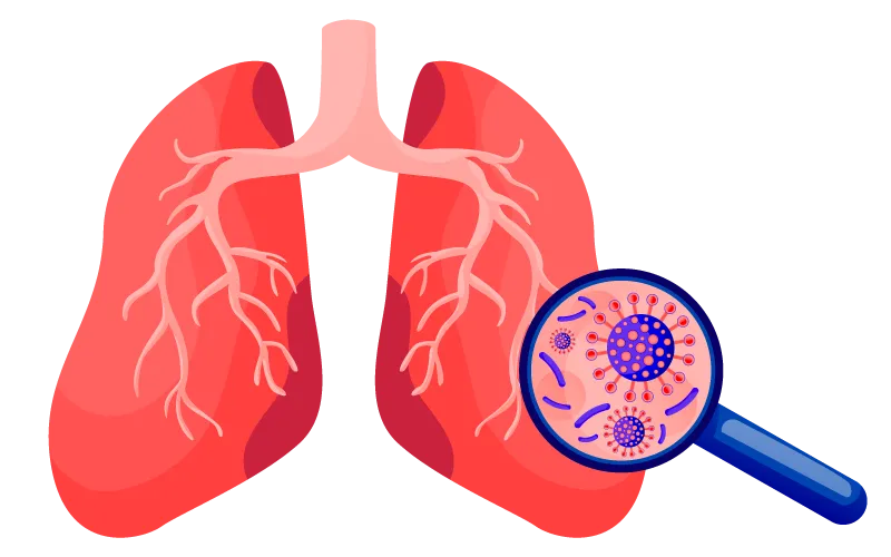 pneumococcal 