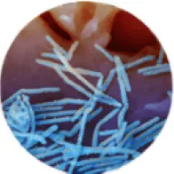 RSV viruses under microscope