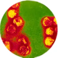 TBE virus 