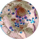 Dengue