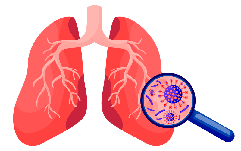 pneumococcal