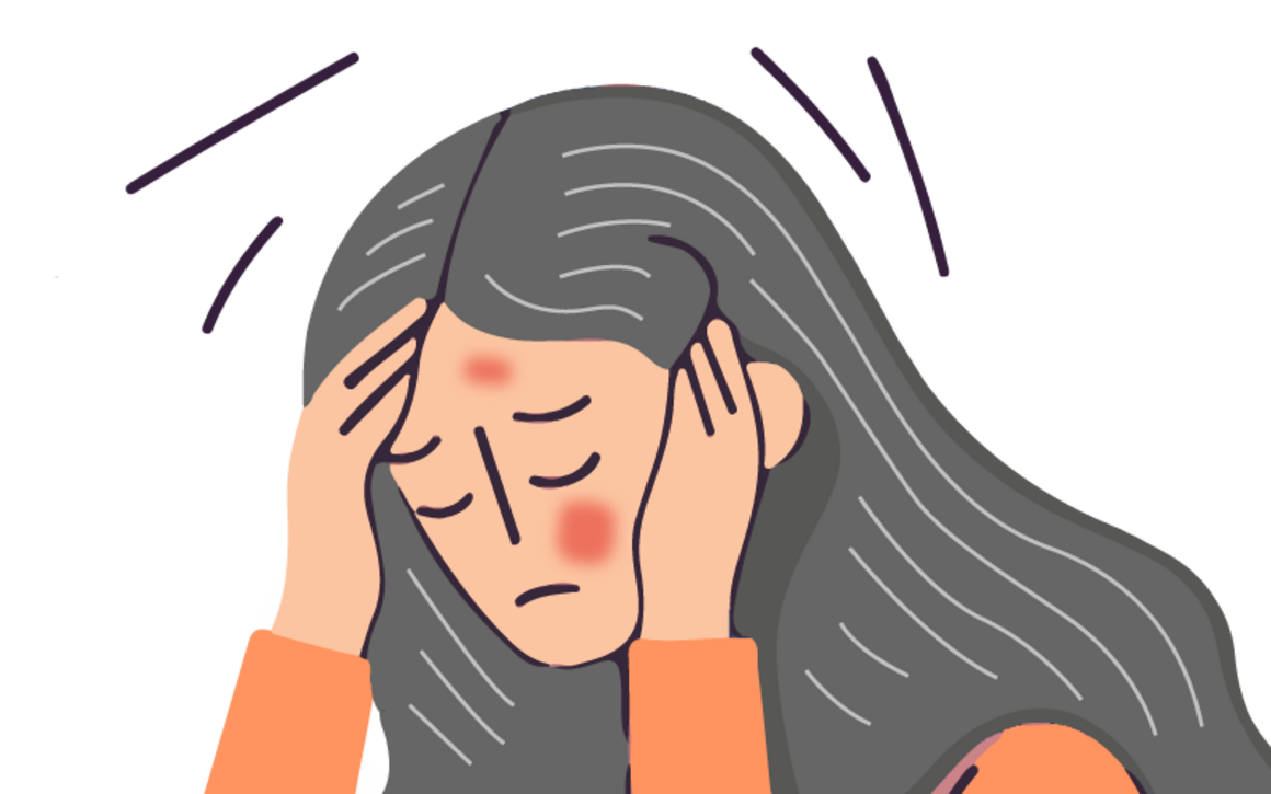 Woman with shingles has headache