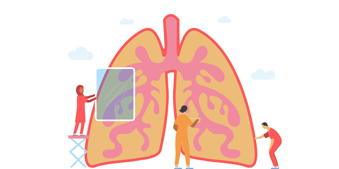 Symptoms of pertussis