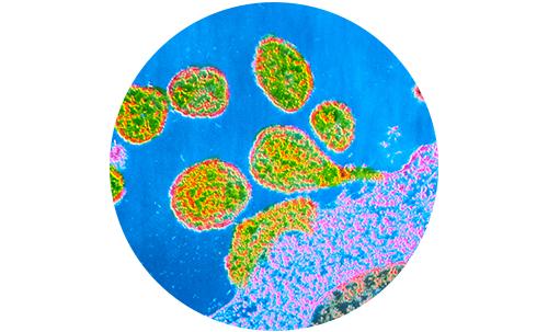 Røde hunder (rubella)